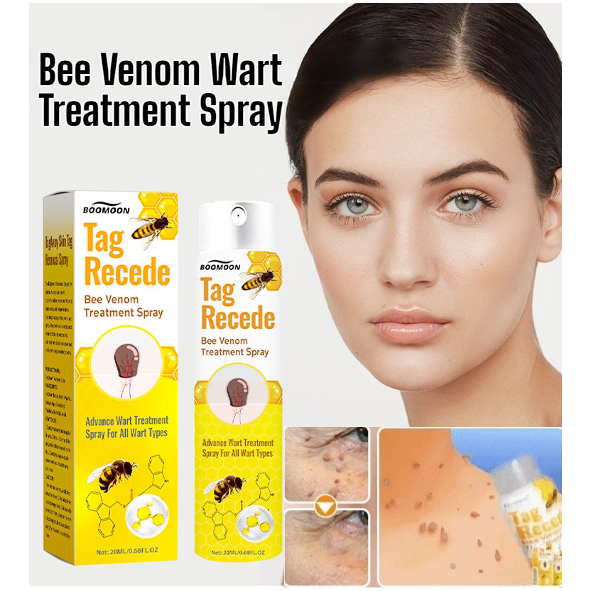 💓HOT SALE💓【Wart Removal】Bee Venom Spray Wart Spray Boomoon Bee Venom ...