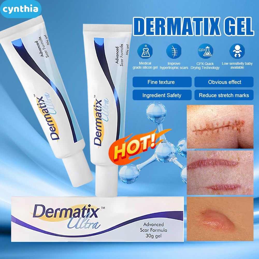 Dermatix Ultra Original Acne Scar Gel Scar Reduction Cream Dermatic ...