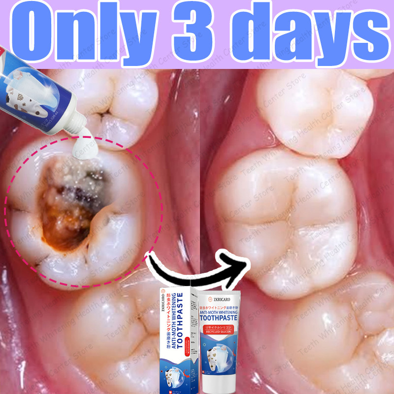 Anti-caries toothpaste, teeth repair toothpaste Tooth Decay Repair deep ...