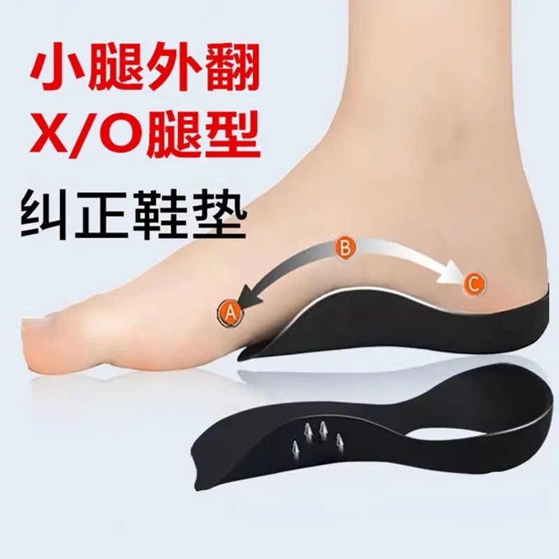 O-shaped Leg Flat Foot Correction Insole Foot Valgus Calf Valgus ...