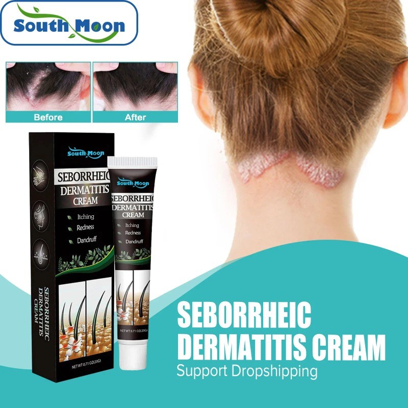 Seborrheic Dermatitis Cream Treatment Psoriasis Eczema Head Acne ...