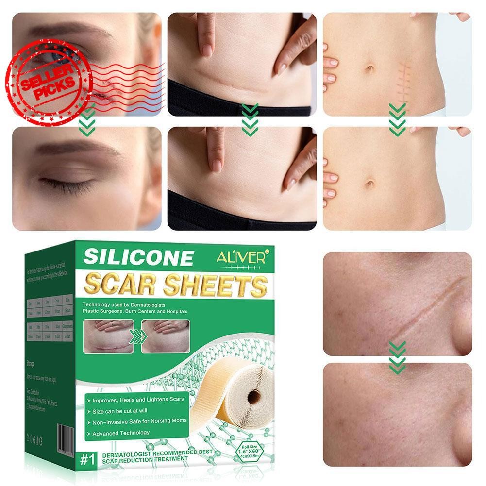 Silicone Scar Removal Tablets Effective Scar Repair Sticker B3z1 ...