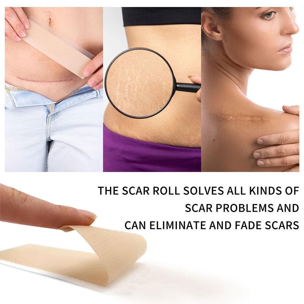 Silicone Scar Removal Tablets Effective Scar Repair Sticker K4w7 ...