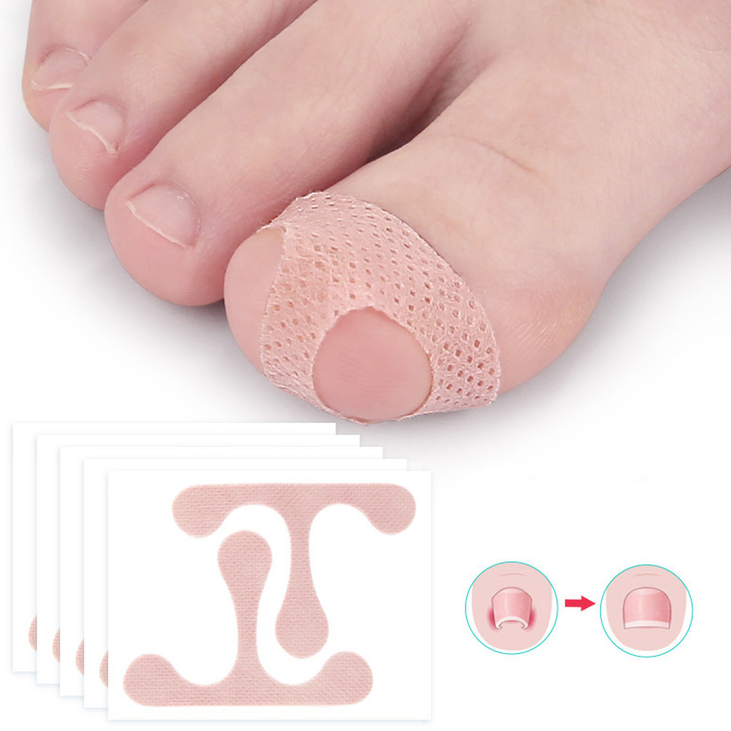 [kats] 5 Sheets Toenail Corrector Sticker T Shaped Elastic No Glue ...