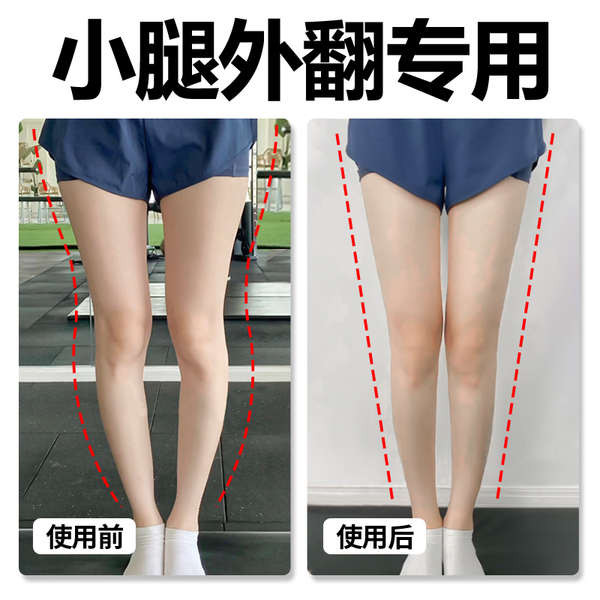 O-Type Leg Correction Leg Corrector o leg Ia sesuai untuk pembetulan ...