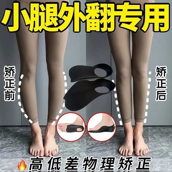 o leg O-Type Leg Correction Leg Corrector 【Kepakaran Ortopedik Jepun ...