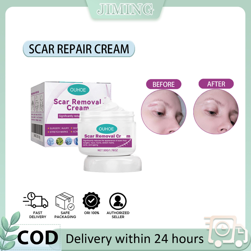 OUHOE Scar Removal Cream Repair Scars Operation Scald Cream Old Scars ...