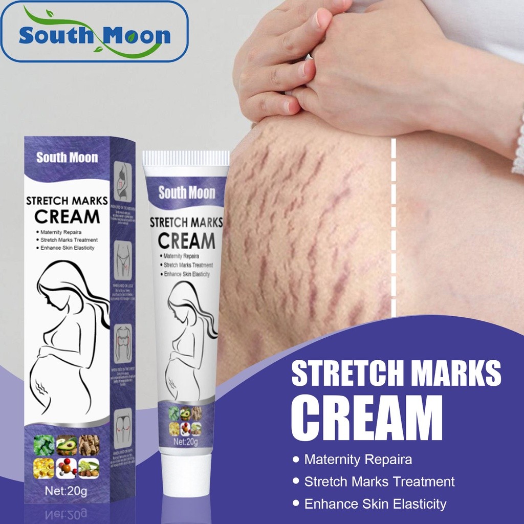 [South Moon] Stretch Mark Repair Cream 20g Special for Pregnancy ...