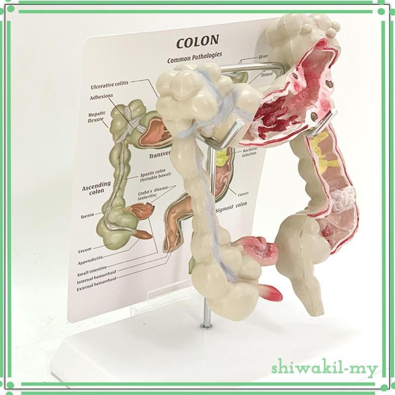 [ShiwakiffMY] Human Colon Model Realistic Large Intestine Model with ...