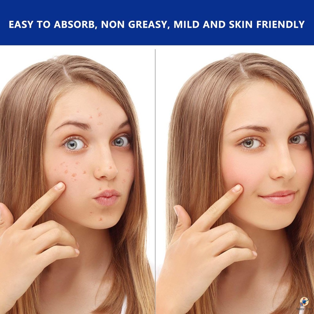 MOOYAM Acne Scar And Stretch Mark Removal Cream - Acne Removal Cream For Acne On Legs