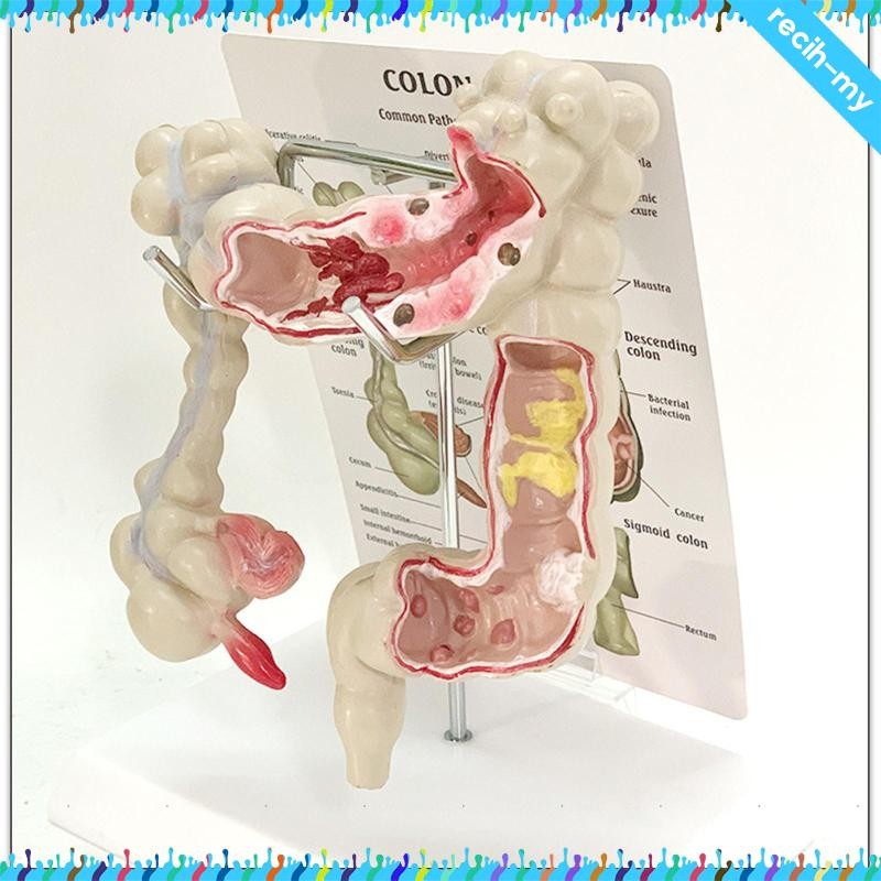[RecihMY] Human Colon Model Large Intestine Model Lightweight Teaching ...