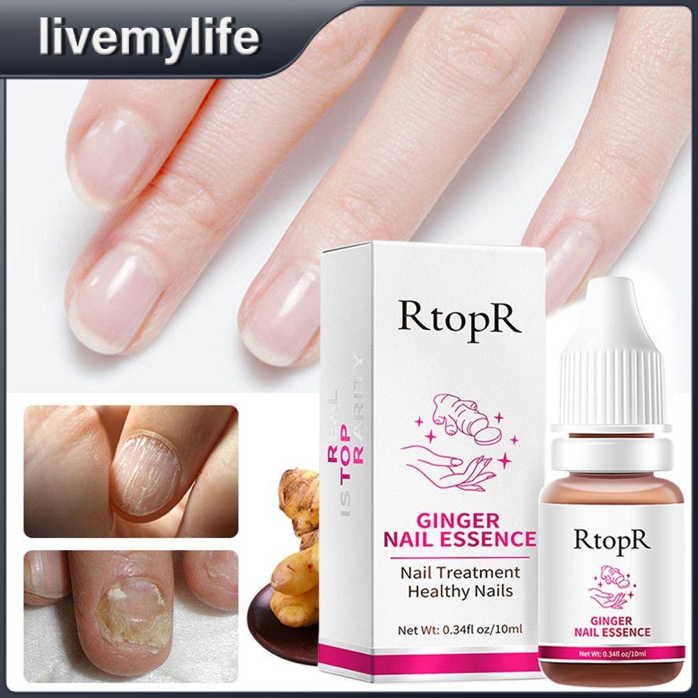 RtopR Ginger Antibacterial Nail Treatment Essential Anti Fungal ...