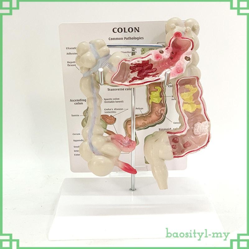 [BaositybfMY] Human Colon Model Realistic Large Intestine Model with ...