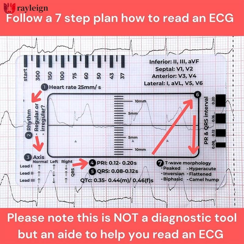ECG 7 Step Ruler, ECG 7 Step Ruler for ECG/EKG Interpretation, Rapid ...