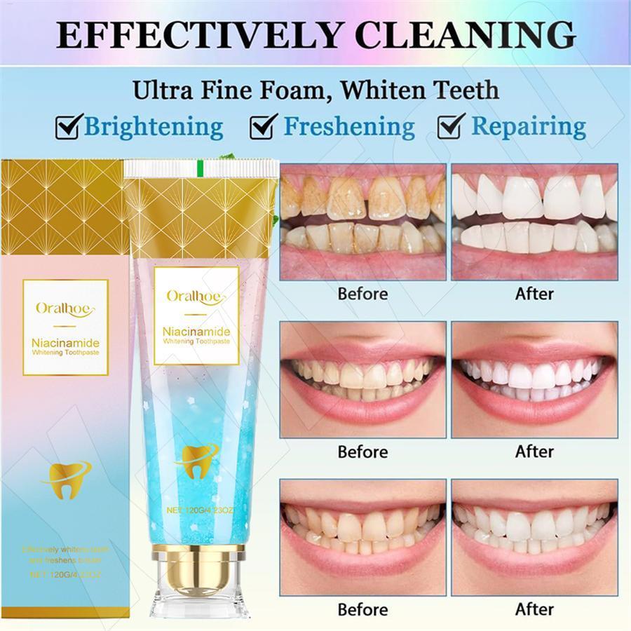 Brighter Teeth Toothpaste 100g Teeth Cleaner Toothpaste Odor Remover ...