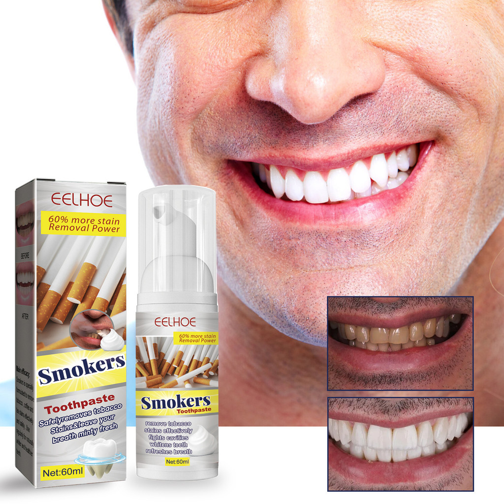 EELHOE Toothpaste Toothpaste Tooth Yellow Decontamination Toothpaste ...