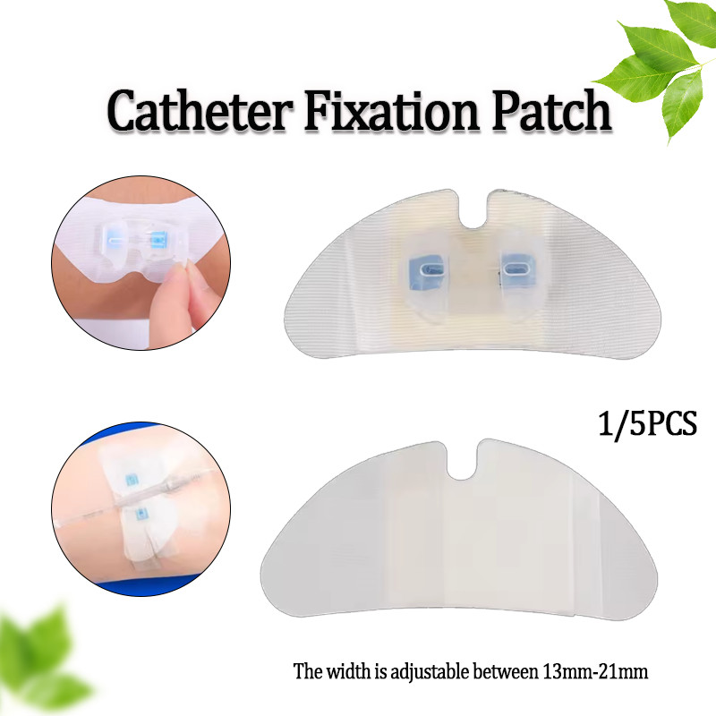 Medical Catheter Fixation Patch Body Surface Catheter Fixation Device ...