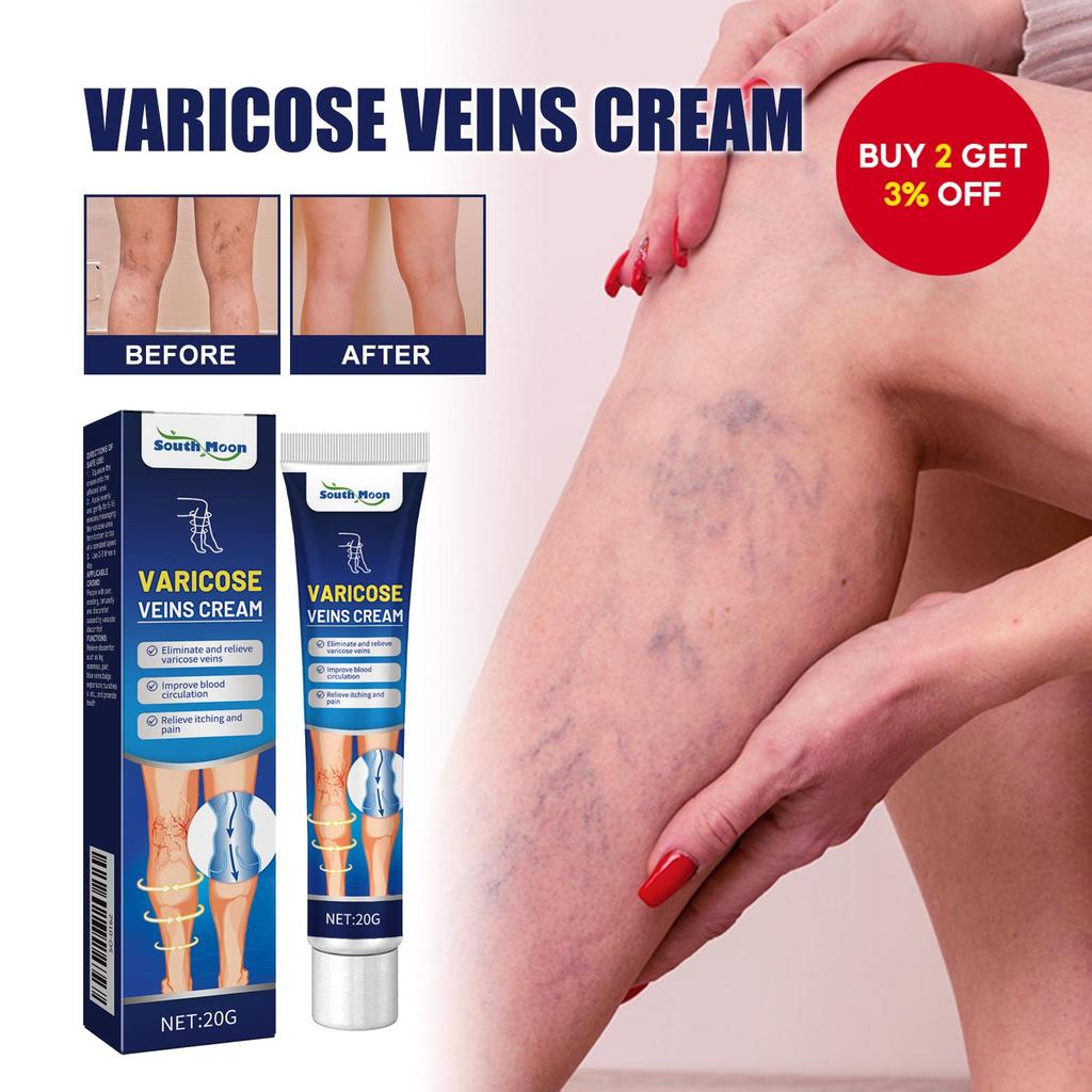 Professional Varicose Vein Care Cream 20g – Leg Vein Formula for ...