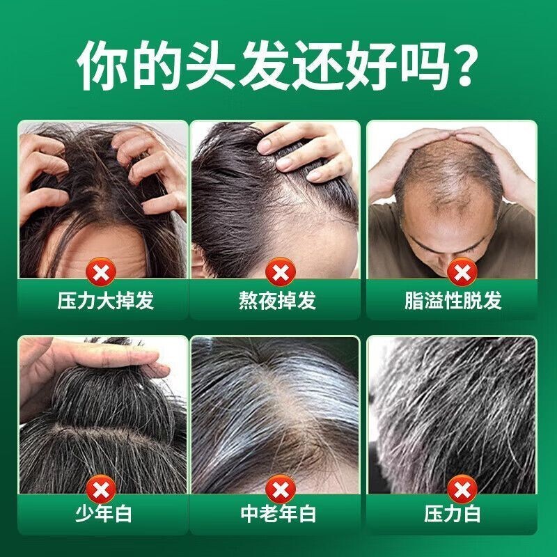 ((Genuine Product) L-CALORIE Biotin Matching redhalo Biotin Matching ...