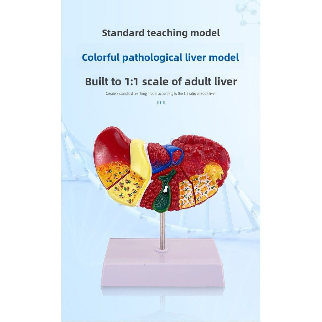 Medical simulation human liver anatomy model hilar gallbladder bile ...