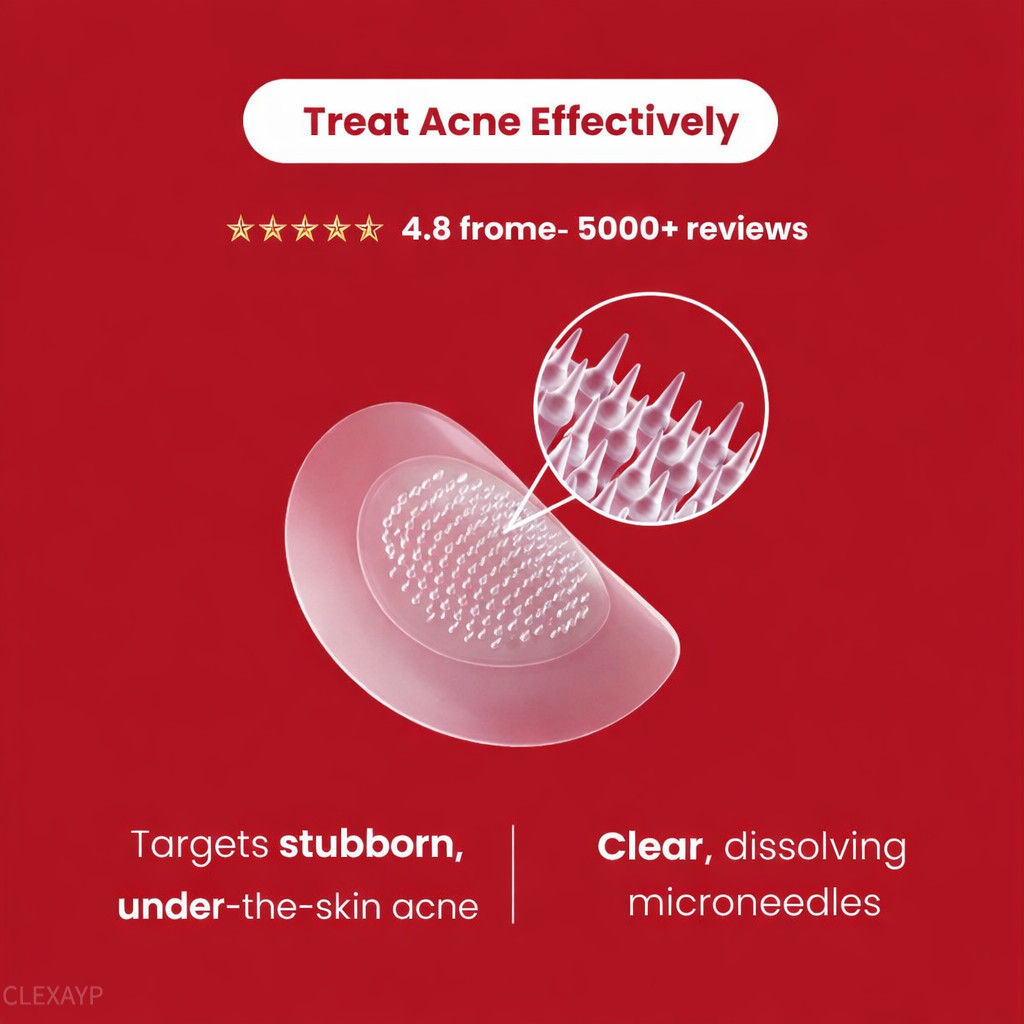 CLEXAYP Microdarts for Acne Microneedle Patches Hydrocolloid for Blind ...