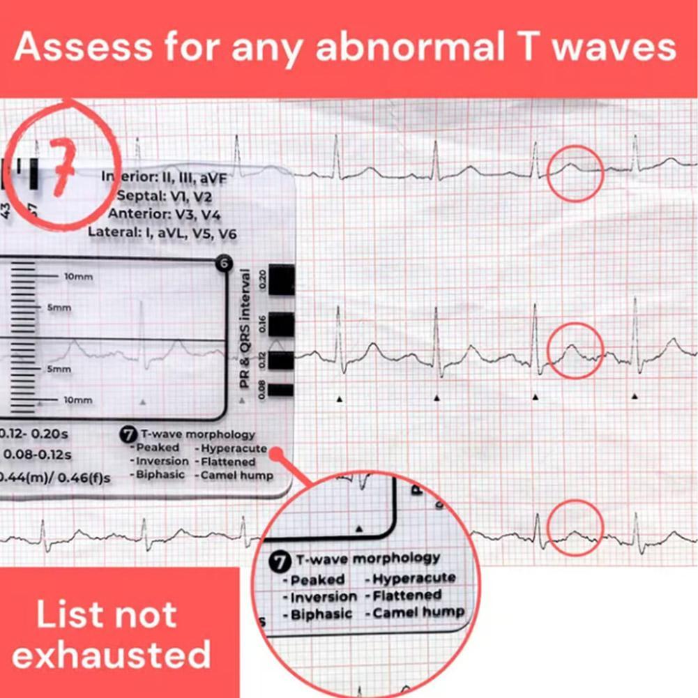 Ekg Pvc Badge Card – Accurately Interpret Ecg/ekg Rhythm Ecg Step ...