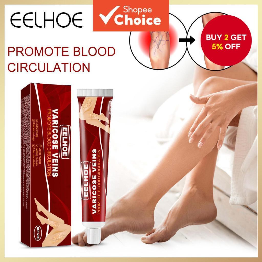 Varicose Vein Cream Venous Massage Ointment Earthworm Leg Inflammation ...