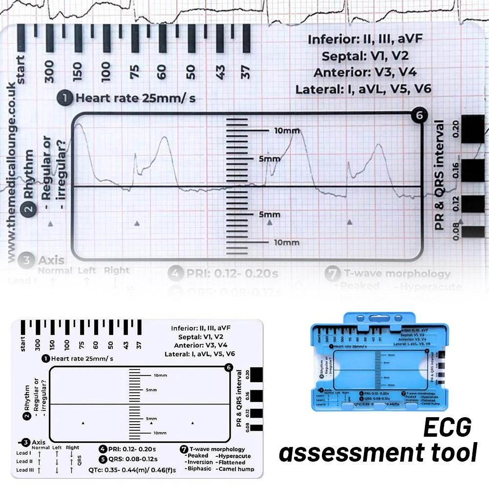 Ekg Pvc Badge Card – Accurately Interpret Ecg/ekg Rhythm Ecg Step ...
