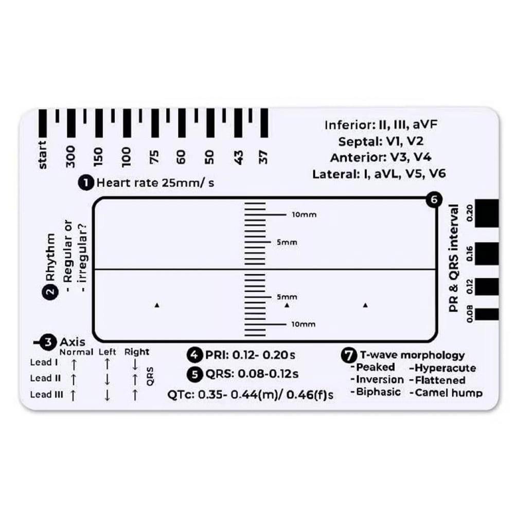 Ekg Pvc Badge Card – Accurately Interpret Ecg/ekg Rhythm Ecg Step ...