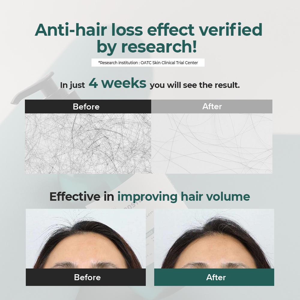 [GRAFEN] Root Booster Shampoo 500ml x2 [AntiHair Loss, For Dry Hair