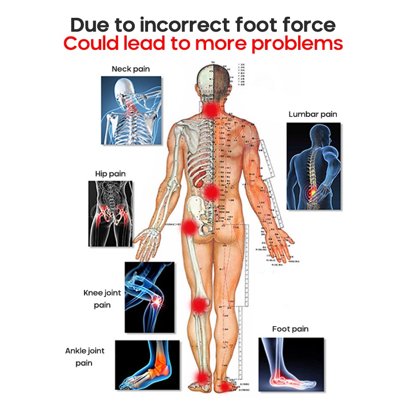 Arch Support Flatfoot Corrector Orthopedic Insole X O Leg Correction ...