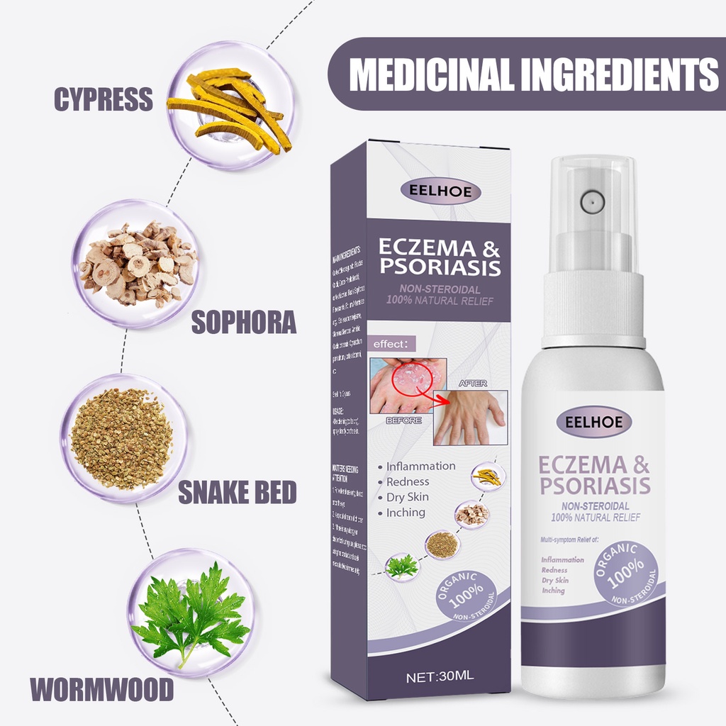 EELHOE Herbal Eczema Psoriasis Spray Antibacterial Dermatitis Athletes ...