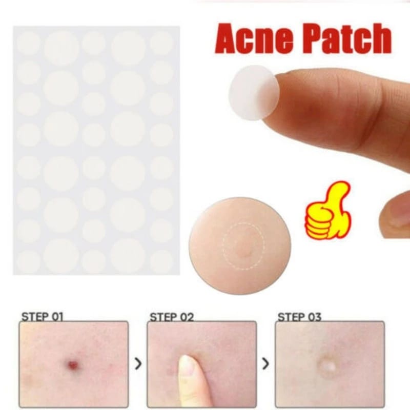 36pcs Invisible Acne Pimple Removal Patch Acne Hydrocolloid Stickers ...