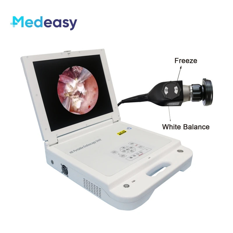 Full HD Portable Endoscopy Camera Unit, Endoscope Camera System with ...