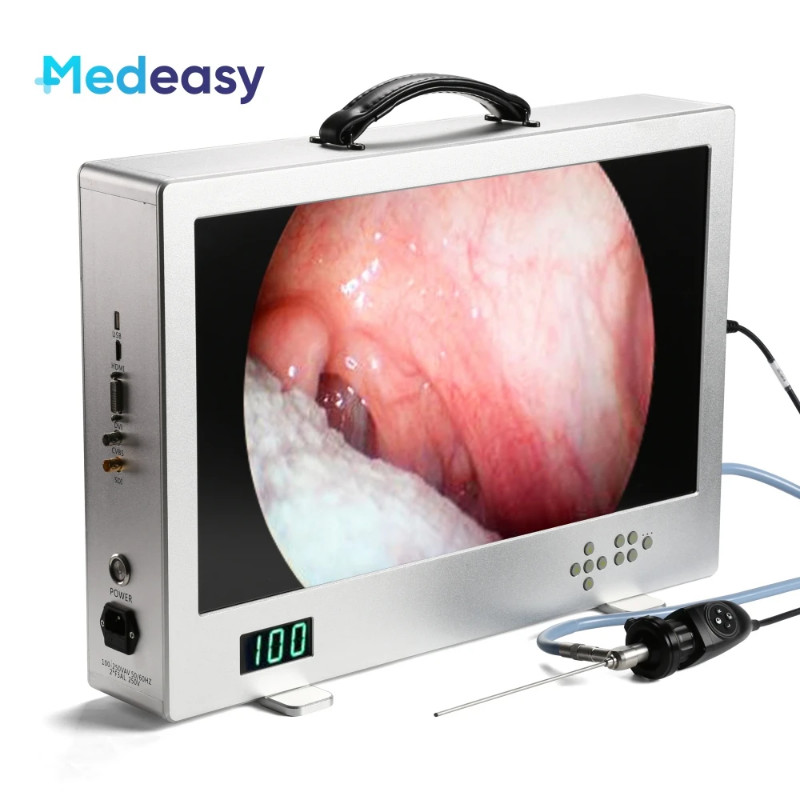 24 Inch Full HD Endoscope Camera with Monitor and 80W Led Light Source ...