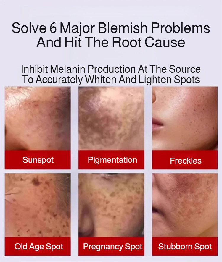 uneven Spot Cream beauty cream White and tender all over the face ...
