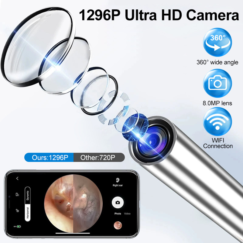 15-in-1 Smart Visual Ear Picker Kit with 2.5mm Earpick & Otoscope ...