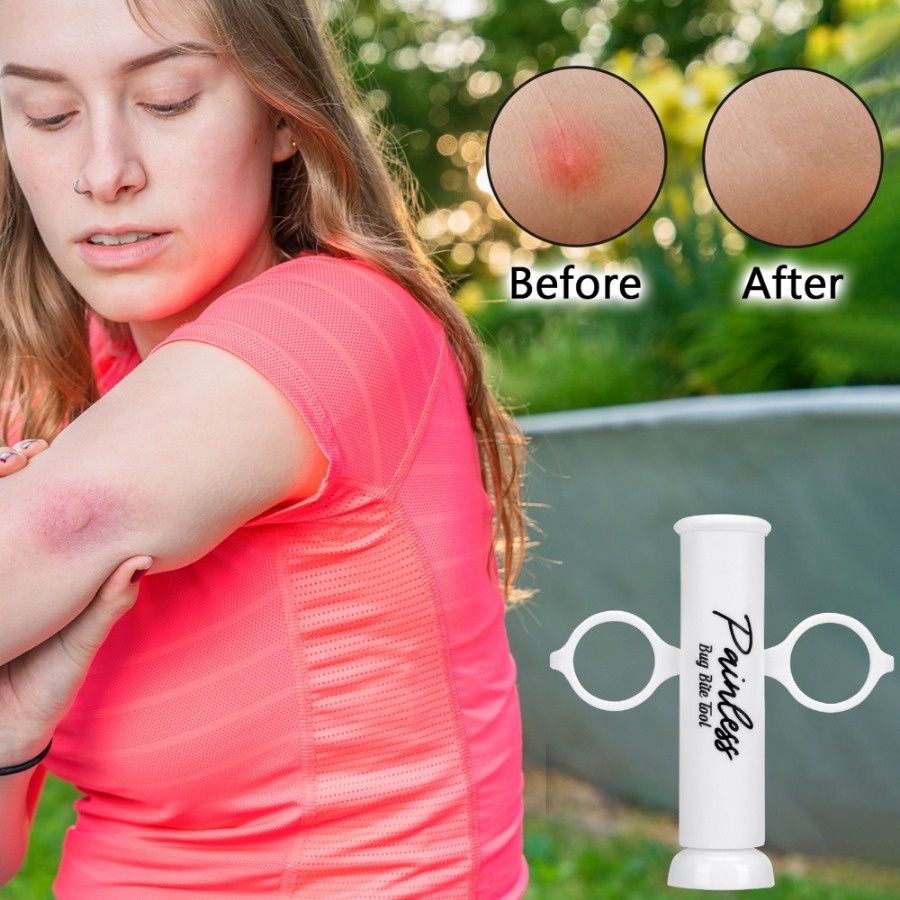 Bug Bite Venom Extractor Vacuum Poison Extractor Instant Relief ...