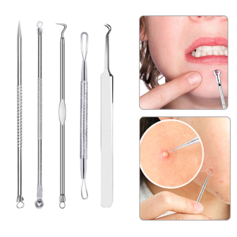 Pimple Kit Set Stainless Steel Pimple Tools Extractor Needle Blackhead ...