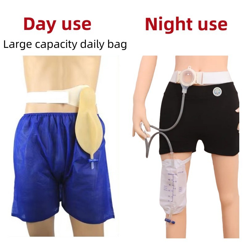 Urostomy Bag Urine Bag Lateral Bladder Urinary Ostomy Bags Stoma bag ...