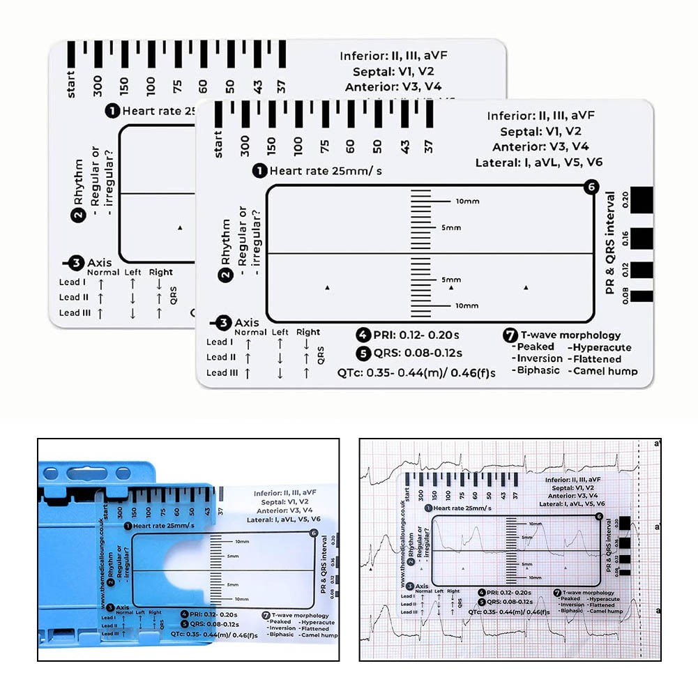 ECG 7 Step Ruler for ECG/EKG Clear EKG Plastic Caliper Measuring Tool ...