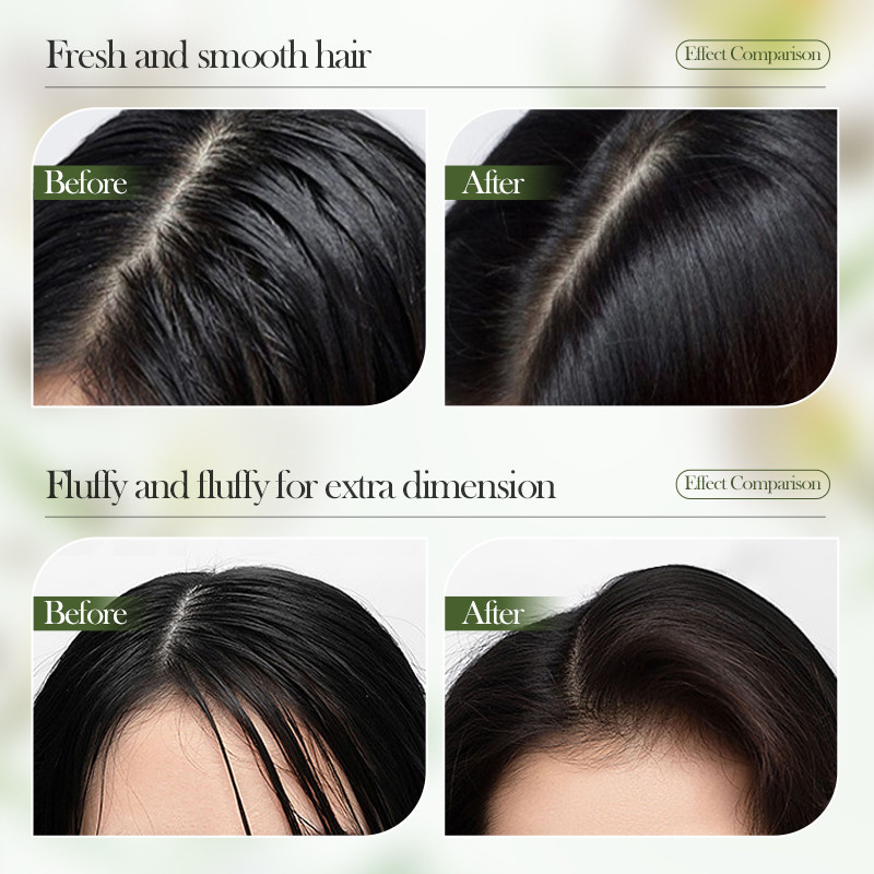 ROREC SADOER Rosemary Volumizing Shampoo Anti-Dandruff Anti-Itch ...