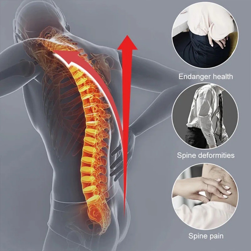 Adjustable Posture Corrector Back Supportfor Hunched Back Kyphosis and ...