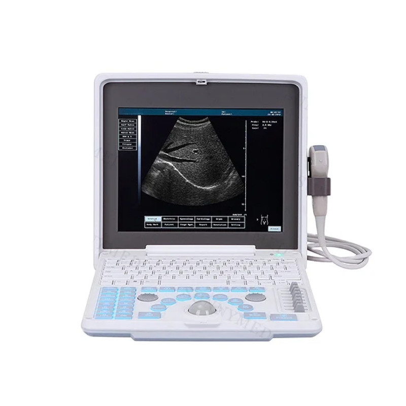 SY-A003 Medical Ultrasound System Ultrasound Device Obstetrics Abdomen ...