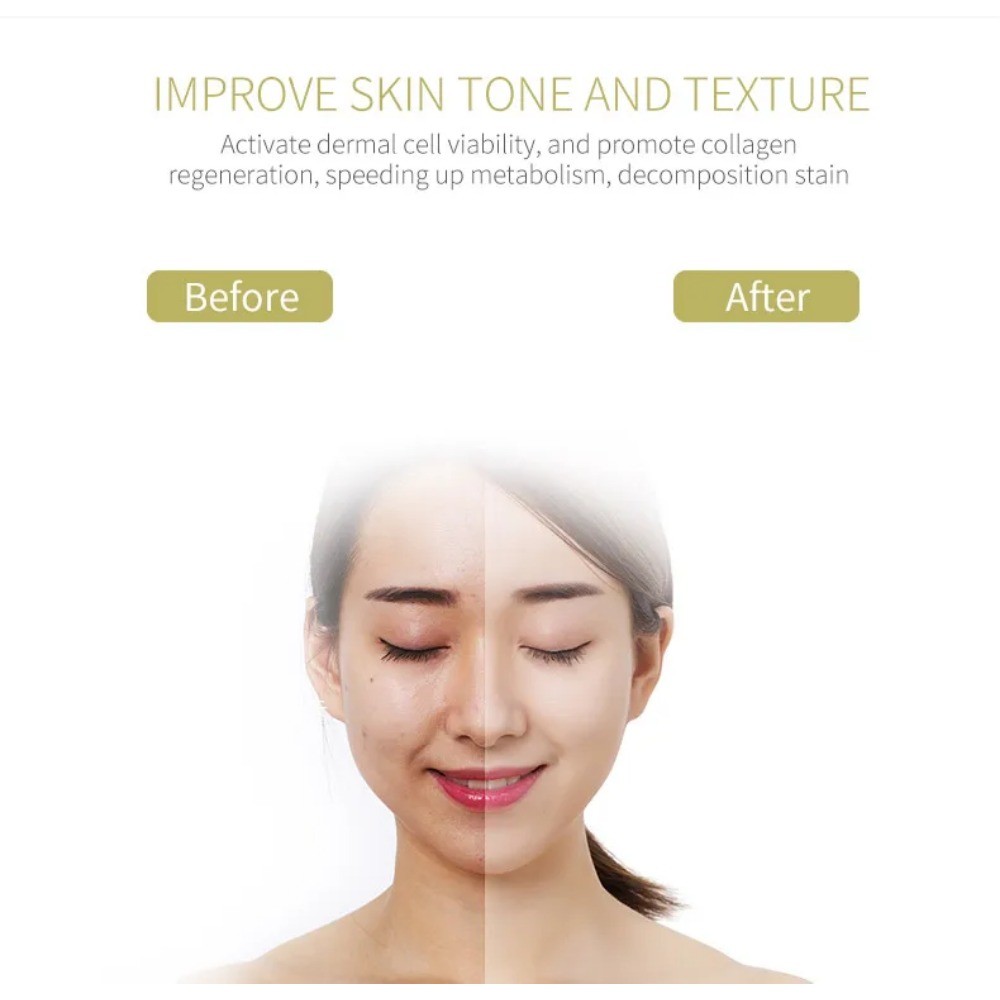 7 in 1 Face Lifting Device EMS Microcurrent Skin Rejuvenation Facial ...