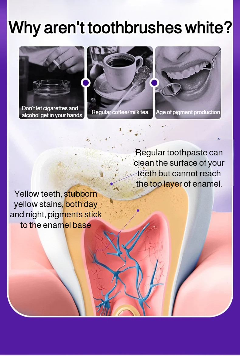 Tartar removal Toothpaste Whitening Toothpaste Stain remover ...