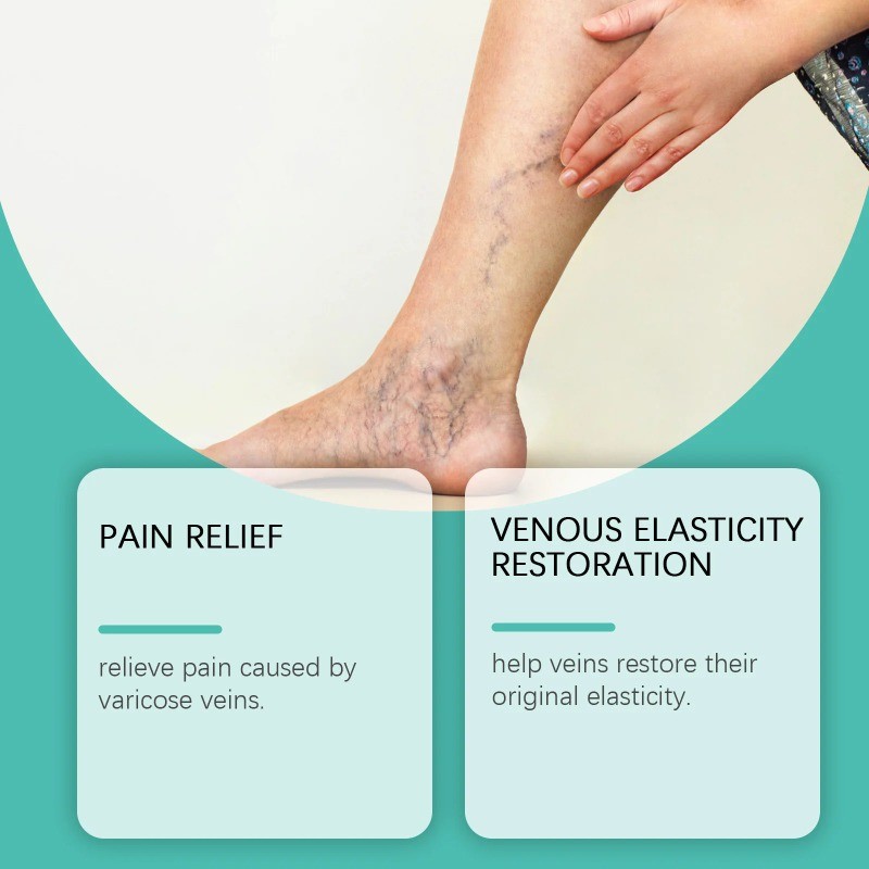 Varicose Vein Patch Vasculitis Remover Spider Leg Treatment Phlebitis ...