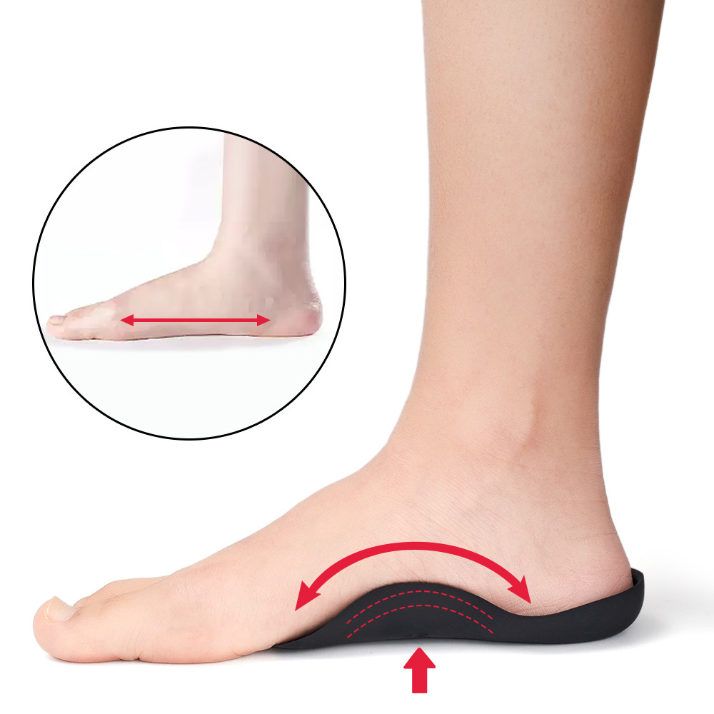Reusable Flat Foot O/X-Shaped Leg Correction Insoles - Female Man ...