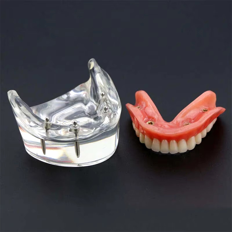 Dental Model Sold On United States