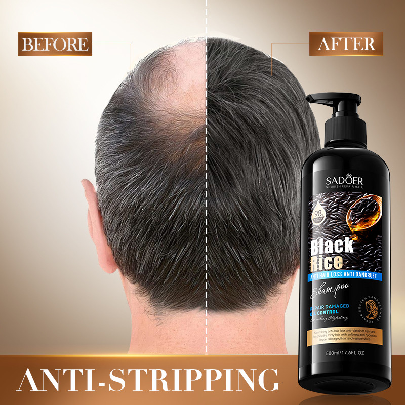 ROREC SADOER Black Rice Anti Hair Loss Anti Dandruff Shampoo Repair